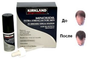 Kirkland, Minoxidil 5%, Рогейн, Миноксидил, Рогаин, Регейн, Rogane 2%